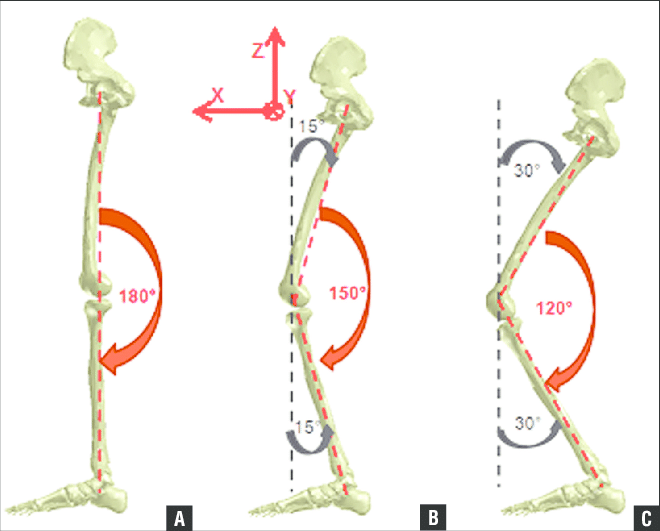 Global-position-of-the-leg-model-for-knee-flexion-0-A-30-B-and-60-C.png